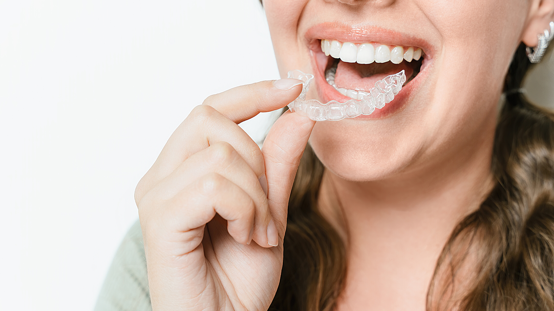 Alinhadores invisíveis Duovero - Transforme seu sorriso